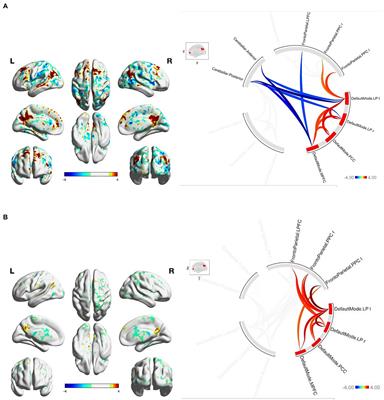 Six month lower-leg mechanical tactile sensory stimulation alters functional network connectivity associated with improved gait in older adults with peripheral neuropathy – A pilot study